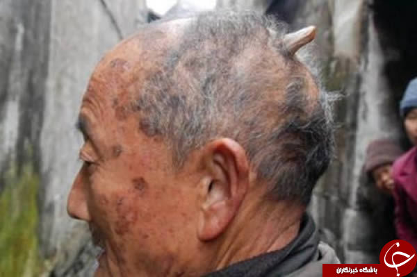 shabnamha.ir , shabnamha , afkl ih , شبنم ها , انسانهای شاخدار; 