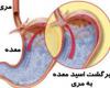 ریفلاکس معده,علایم ریفلاکس معده,درمان ریفلاکس معده,shabnamha.ir,شبنم همدان,afkl ih